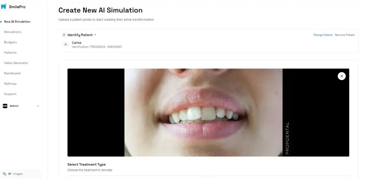 Smilepro screenshot 1